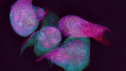 2023_07_20 hla_destaque_T_cell_nuclear_dynamics