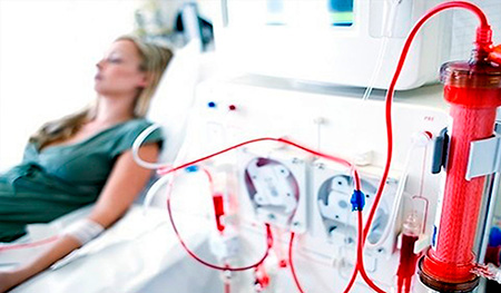 agua-de-Hemodialise-1