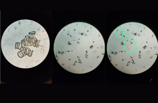 Campos-Ciano-Bacteria-Agua-do-Paraiba-549x357